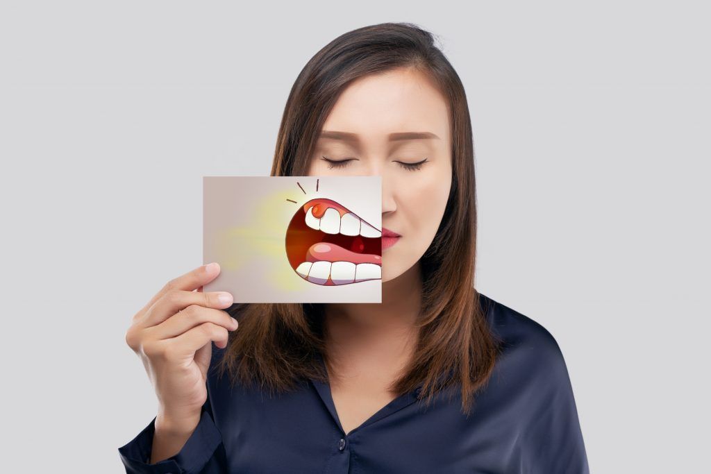 gingivitis