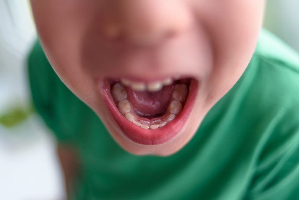 dientes de tiburón