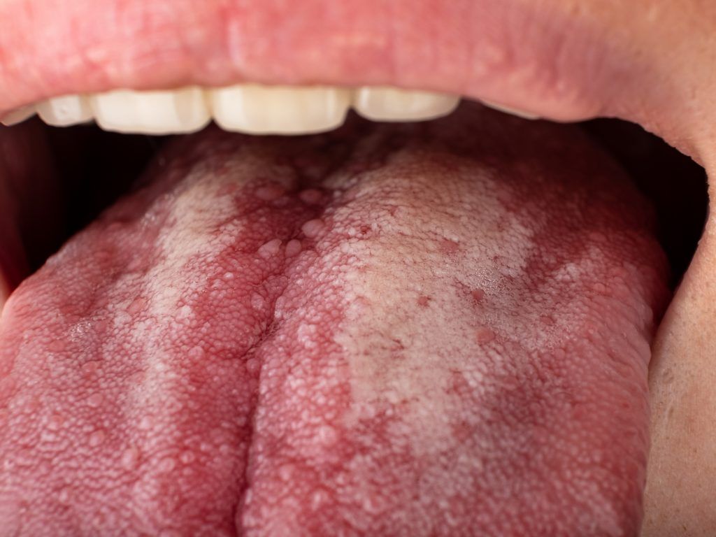 lengua