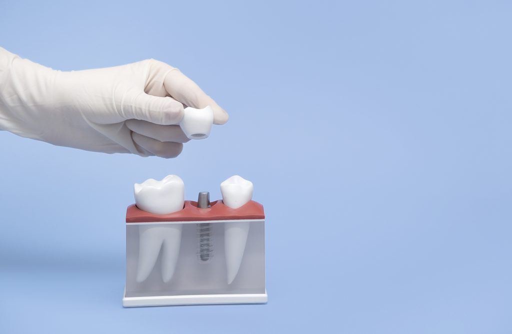 implante dental