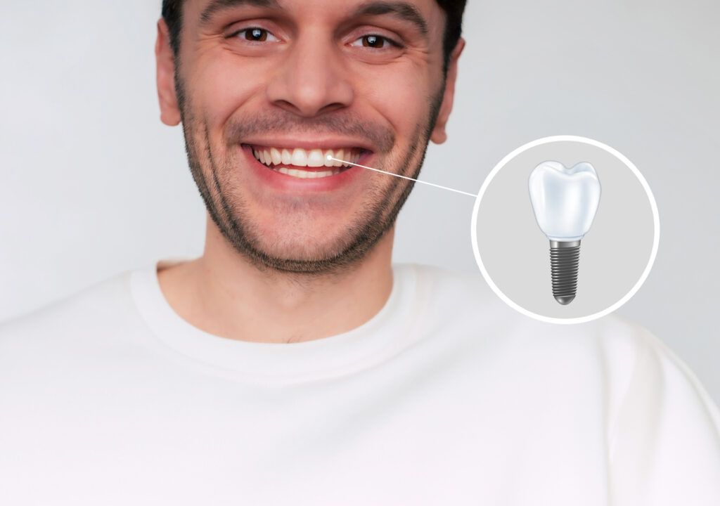 implantes dentales en Don Benito