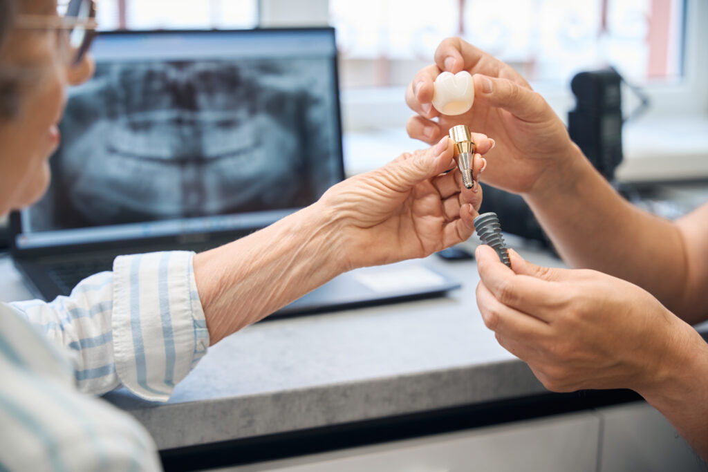 cuidar los implantes dentales