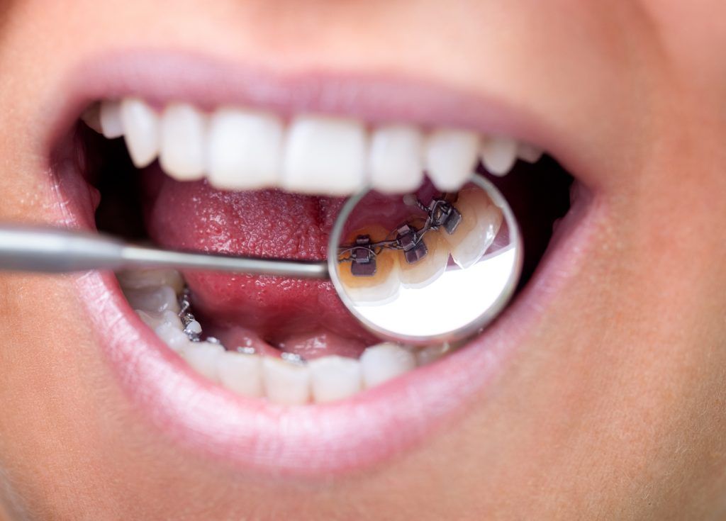 clínica dental en Don Benito