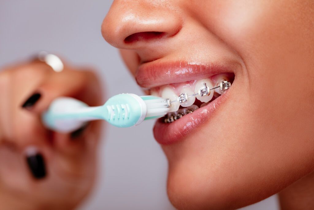 limpiar los dientes con brackets