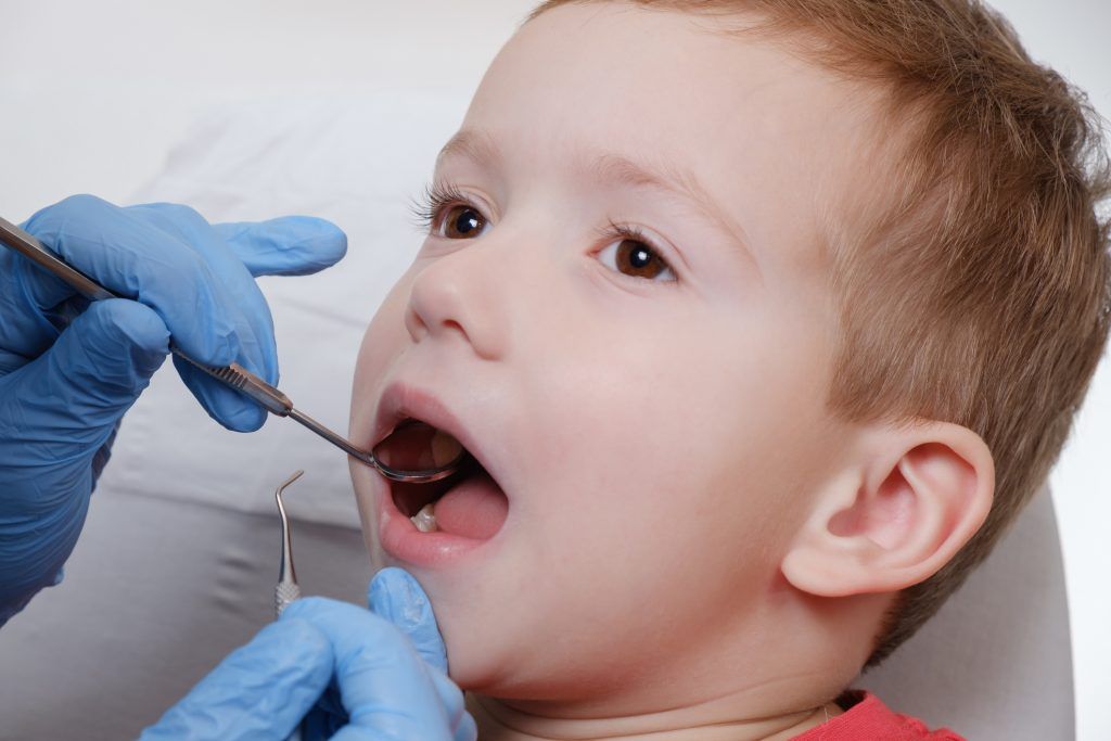 Medical Examination Of Child Patient Teeth Using A Mirror By A Dentist. Caries, Tooth Damage.